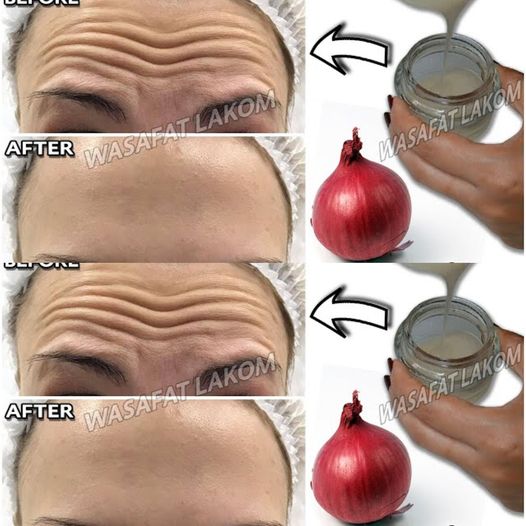 46